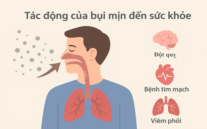 top cac mon an bo phoi giup co the khoe manh giua moi truong nhieu khoi bui